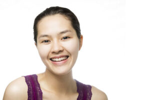 Fix-an-Overbite