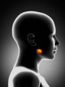 Salivary-gland-stones