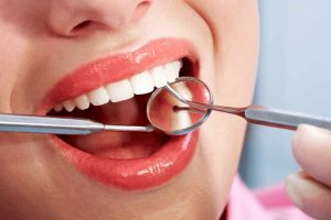 Cosmetic Dental