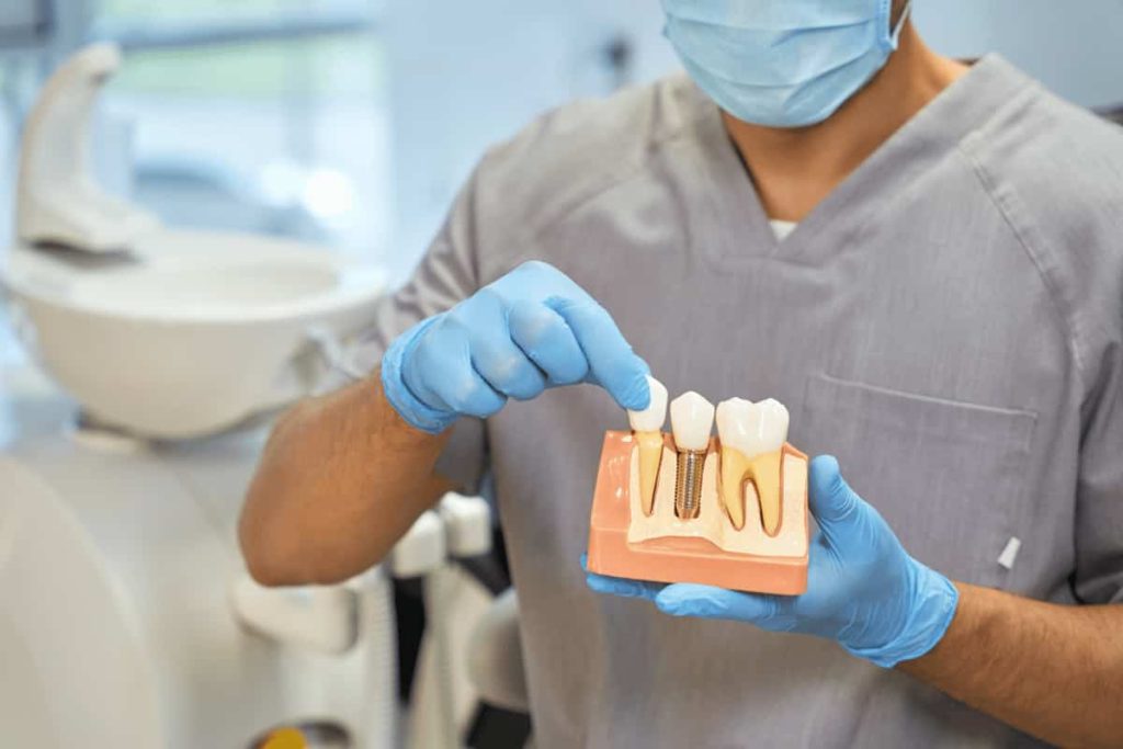 Dental Bridge