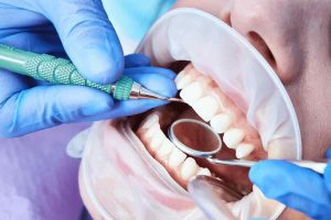 Oral Sedation