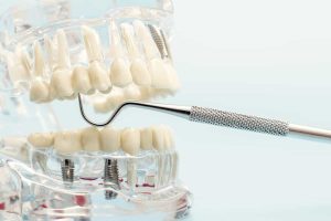 Preventive Dental
