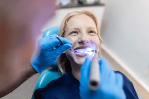 Teeth Whitening (1)