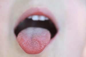Tongues