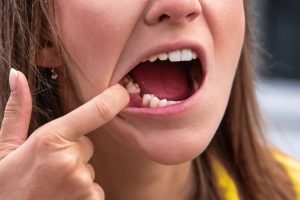 Tooth Growth (1)
