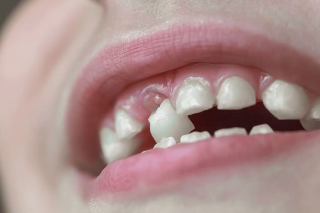 Tooth Growth