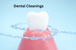 Dental Cleanings (1)