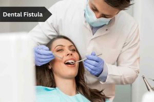 Dental Fistula
