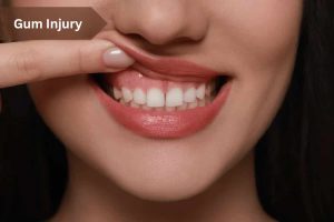 Gum Injury (1)