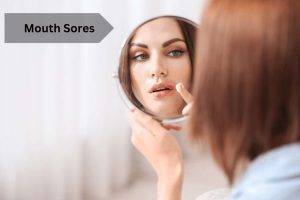Mouth Sores