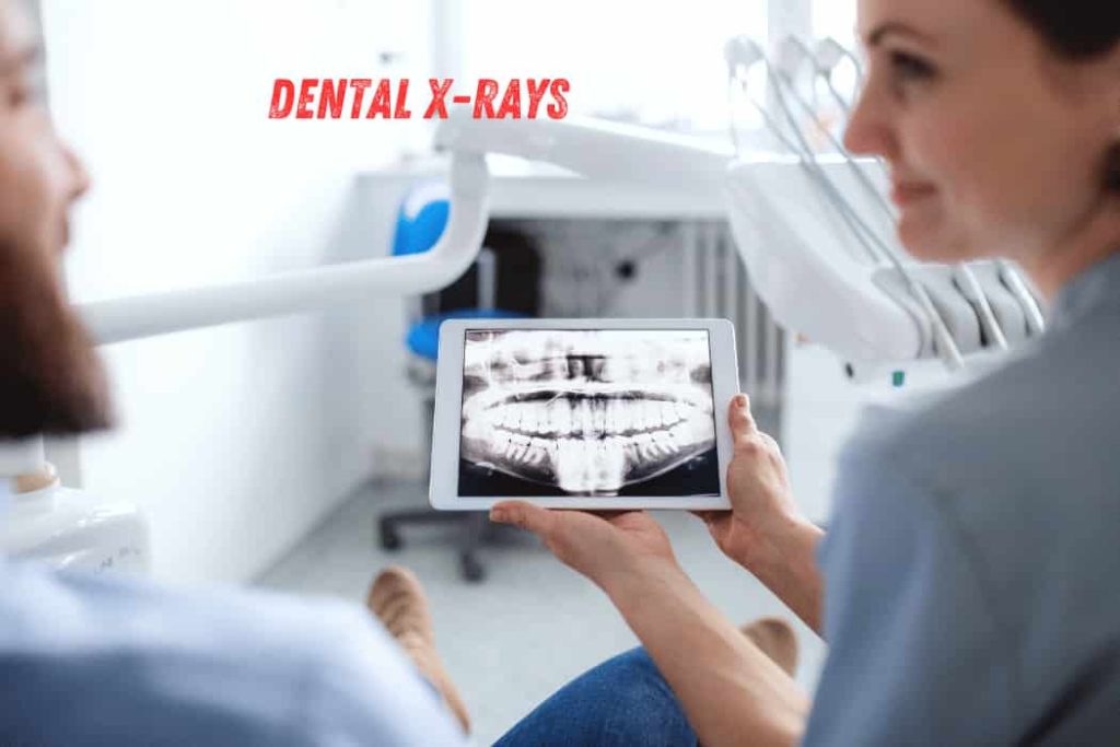 Dental X-rays