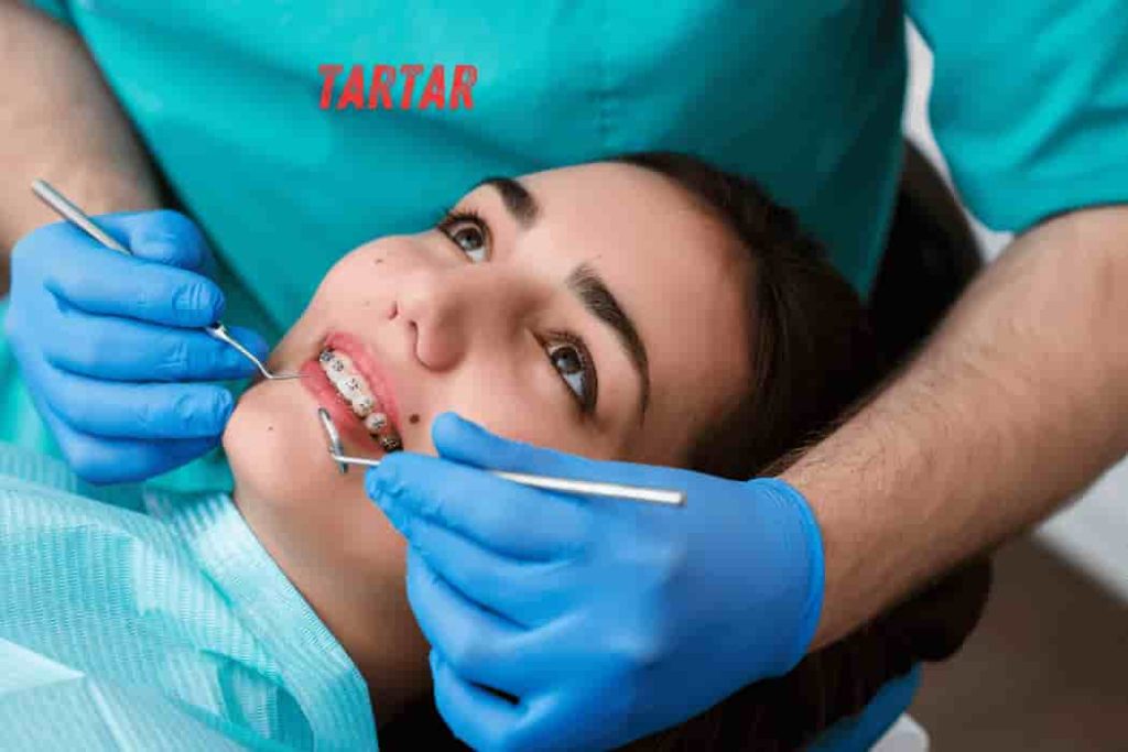 Tartar (1)