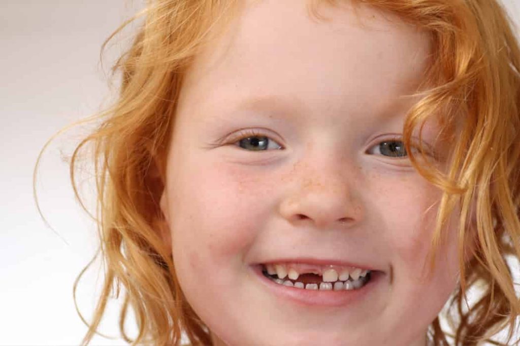 Teeth Gaps (1)