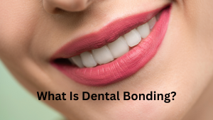 Image of dental bonding, a cosmetic procedure using tooth-colored resin to repair teeth.