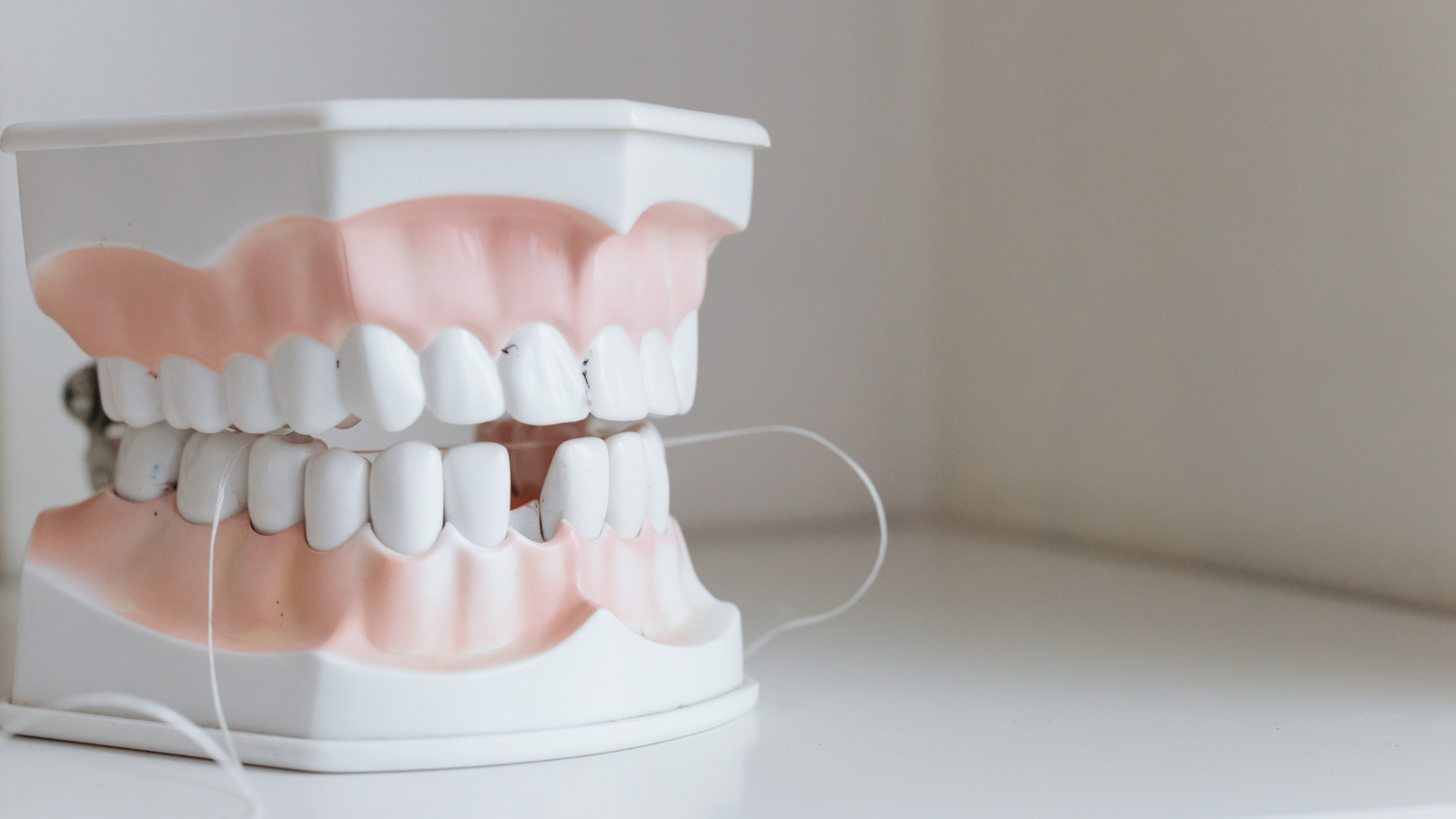 Illustration explaining how long dental bonding typically lasts and its maintenance.