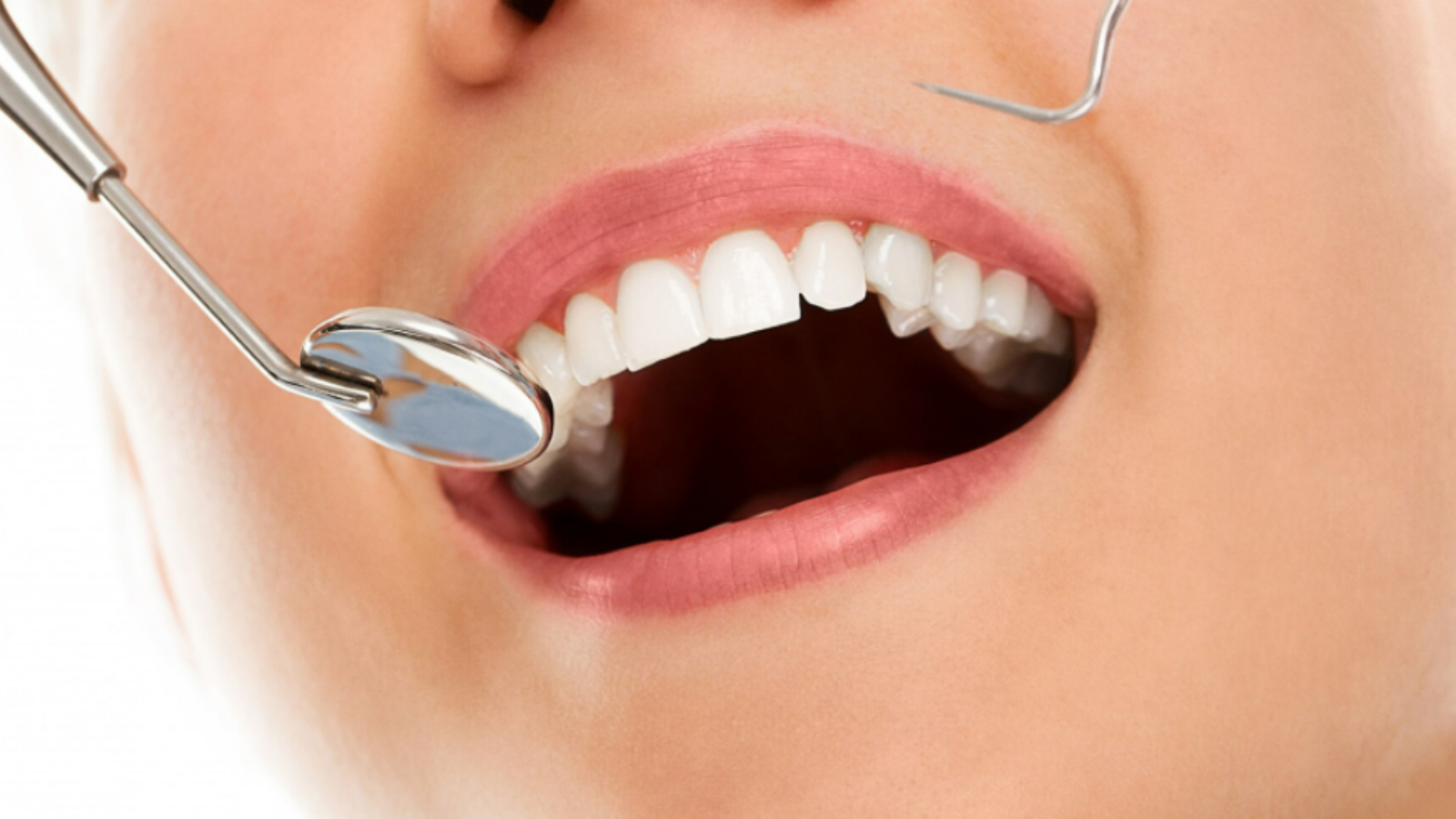 Visual guide of dental bonding and veneers, emphasizing their distinct features in cosmetic dentistry.