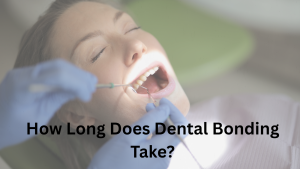 Image depicting the process of dental bonding, highlighting the time it takes for the procedure.