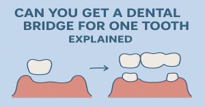 Can You Get a Dental Bridge for One Tooth Explained