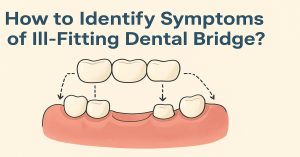 How to Identify Symptoms of Ill-Fitting Dental Bridge
