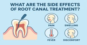 What Are The Side Effects of Root Canal Treatment