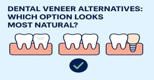 Dental Veneer Alternatives Which Option Looks Most Natural