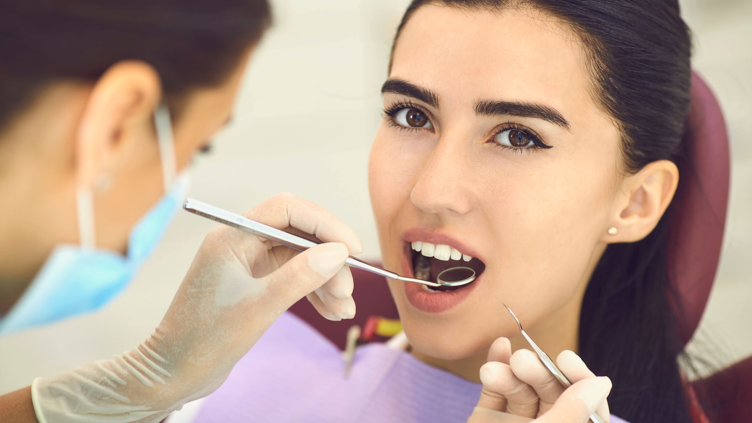 dental veneer alternatives