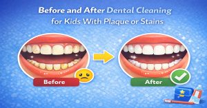 Before and After Dental Cleaning for Kids With Plaque or Stains