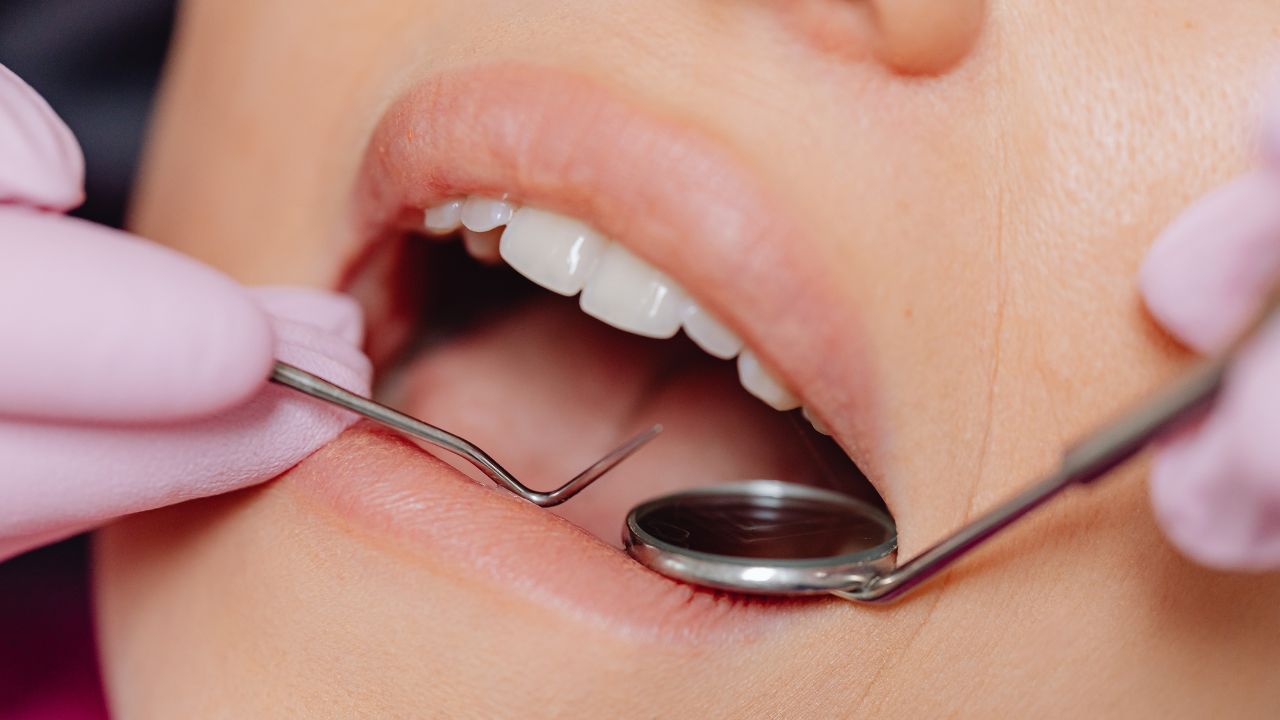 does dental bonding hurt