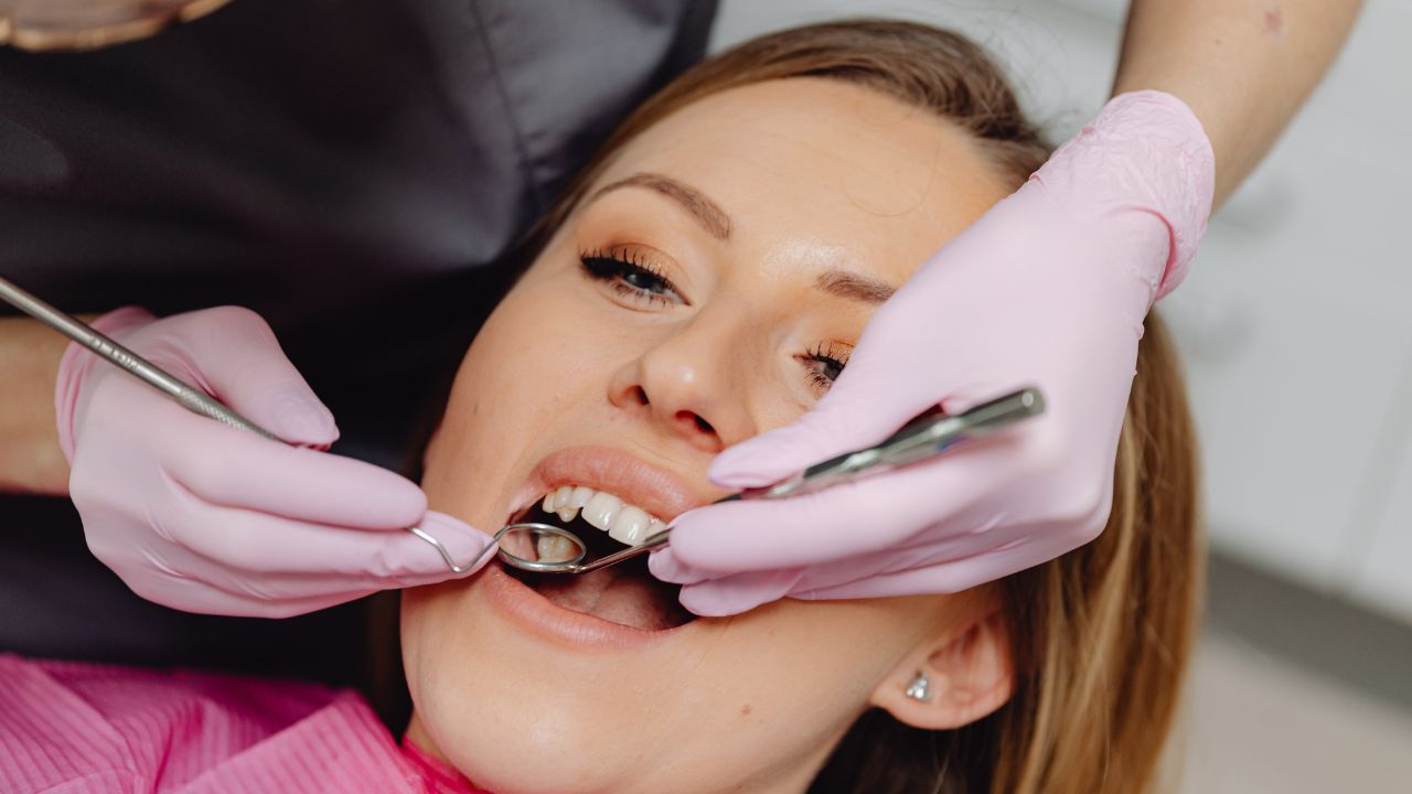 dental bridges and crowns