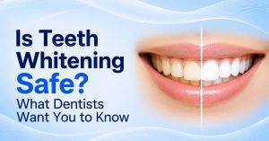 Is Teeth Whitening Safe What Dentists Want You to Know