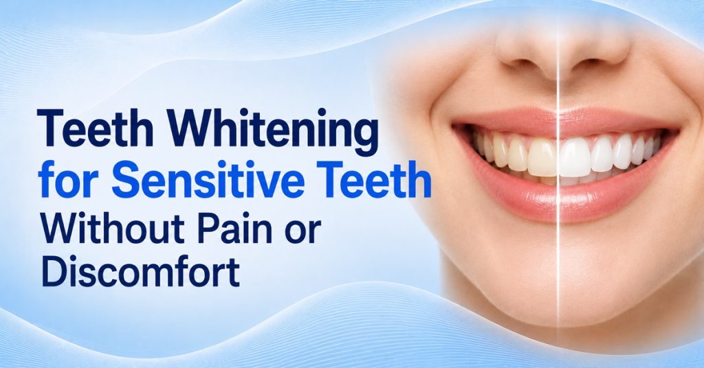 Teeth Whitening for Sensitive Teeth Without Pain or Discomfort