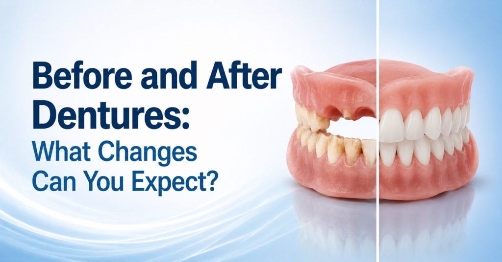 Before and After Dentures What Changes Can You Expect