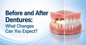 Before and After Dentures What Changes Can You Expect
