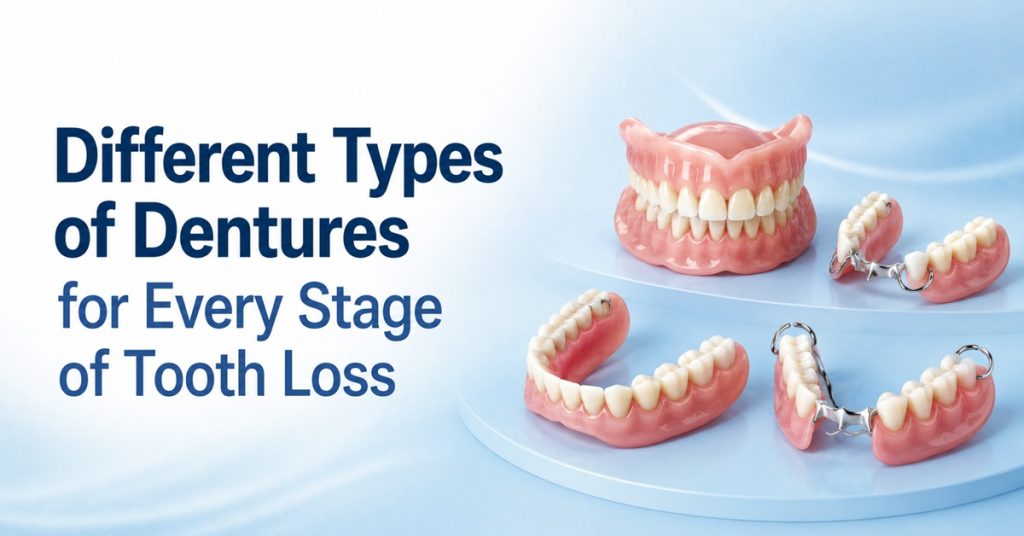 Different Types of Dentures for Every Stage of Tooth Loss