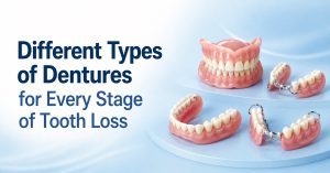 Different Types of Dentures for Every Stage of Tooth Loss