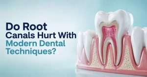 Do Root Canals Hurt With Modern Dental Techniques