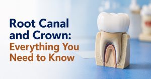 Root Canal and Crown Everything You Need to Know
