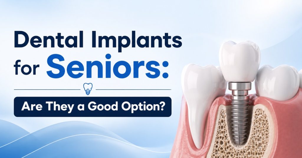 Dental Implants for Seniors Are They a Good Option